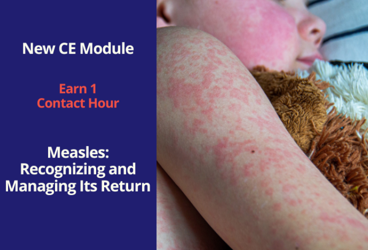 New Continuing Education Module: Measles: Recognizing and Managing Its Return. One contact hour.